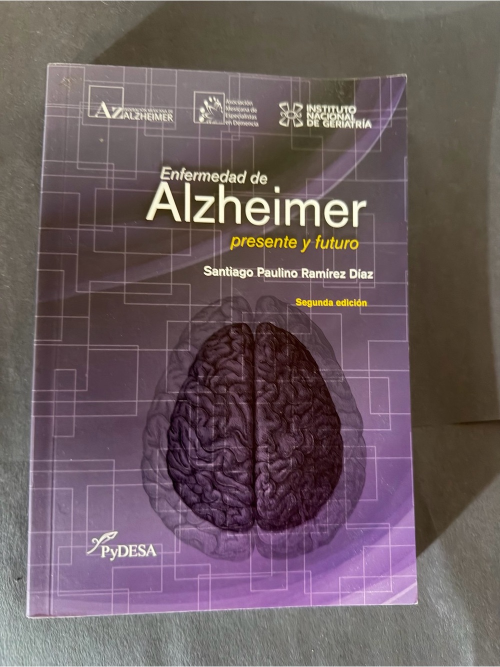 Enfermedad de Alzheimer.Santiago Ramírez